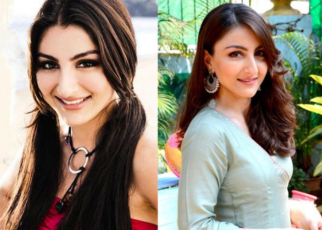 Top 10 Bollywood Actresses With Big Noses Before Plastic Surgery -  