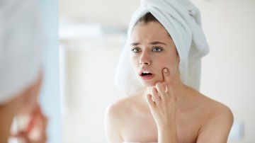 Blackheads are your permanent trouble? Here are the effective ways to remove them forever