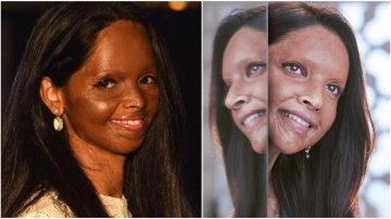 "Chhapaak": Deepika Padukone To Play Acid Suvivor Laxmi Agarwal, Here Is All You Need To Know About Her Life