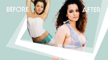 10 Biggest Plastic Surgeries Fails Of Bollywood: Before And After Pictures