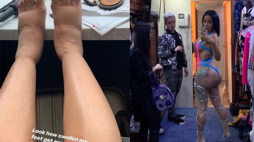 Rapper Cardi B Shares Shocking Images Amid Suffering Plastic Surgery Complications