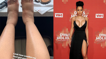 Doctor Warns Cardi B Of Putting Her Life In Life-Threatening Situation Amid Suffering Plastic Surgery Complications