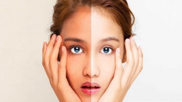 How To Take Care Of Your Face: 5 Best Face And Body Skin Whitening Creams You Must Buy