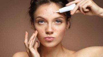 Top 5 Easy Skin Care Rules For Oily And Acne-Prone Skin
