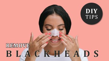 8 Super Simple Tips To Remove Blackheads On Nose Immediately