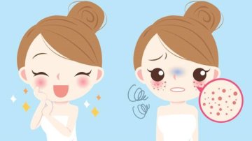 What Is A Blackhead: Causes, Symptoms And Treatments