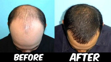 Hair Care Tips Discover The Latest Entertainment News Starbiz Com