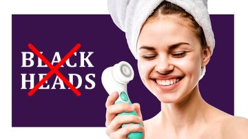 How To Prevent Blackheads: Best Advice Of Dermatologists You Must Notice!