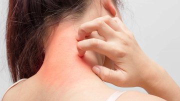 Here Are 8 Tips To Help You Avoid Skin Inflammation, Take A Look!