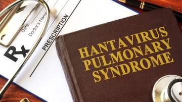 Is Hantavirus As Scary As You Think? Tips To Minimize The Risk