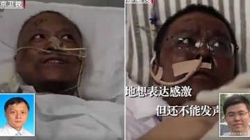 Coronavirus Treatment Can Change Your Skin Color?! Chinese Doctors Infected With The Virus Wake Up With Dark Skin