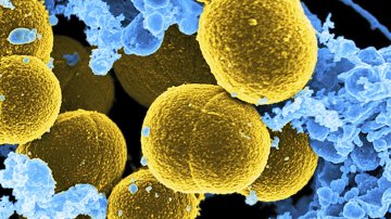 Reports: Doctors Found Coronavirus In Semen Of Patients