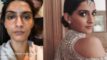 10 Unseen And Shocking Photos Of Sonam Kapoor Without Makeup
