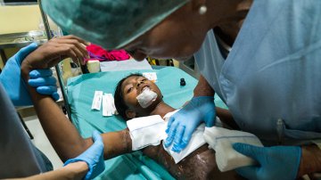 Delhi Wife Burns Herself As Husband Refuses To Buy Smartphone, The Real Reason Is Heartbreaking