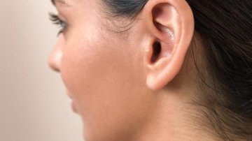 One In Eight Covid-19 Patients Suffer Hearing Loss, Is It Due To Virus Or Side Effects Of Medication?
