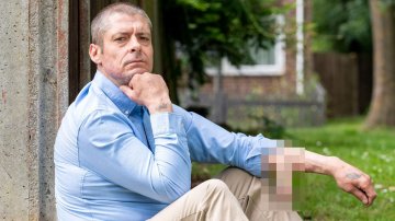 Weird But Real: Doctor Grows New Penis For Dad-of-Two On His Arm After His Dropped Off For Infection