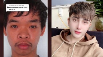 Failling To Get A Job, Man Spends $17,000 On Plastic Surgery To Change His Look