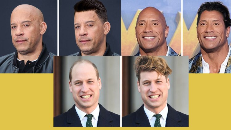 Irresistible Or Unrecognizable, How Bald Celebrities Look When They Have A Full Head Of Hair