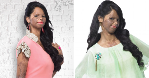 Acid Attack Survivor Laxmi Fashion Model India Fb1
