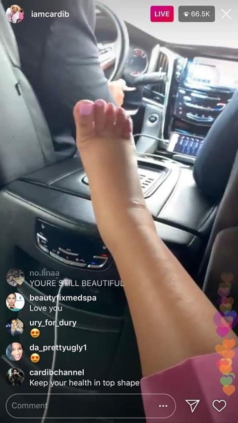 Cardi B Swolen Feet