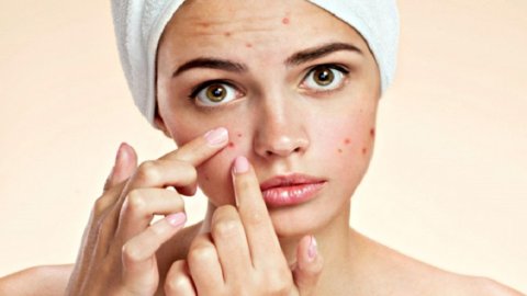 Acne Shutterstock 770x470ll