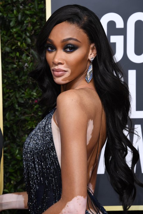 Winnie Harlow