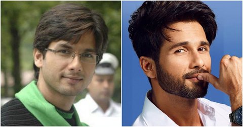11 Shocking Bollywood Male Actors Plastic Surgery Before And After Pics -  