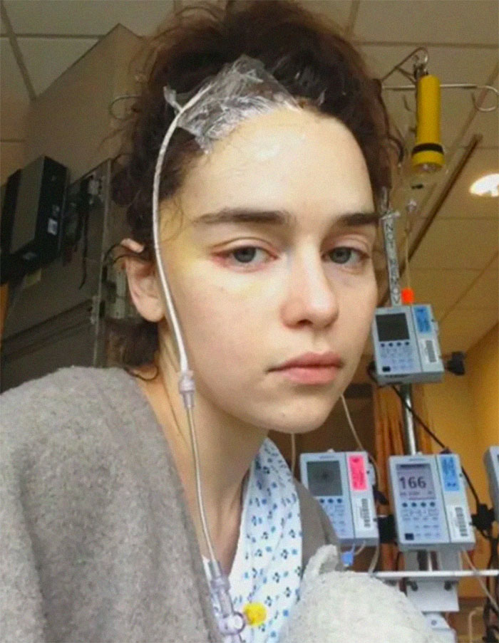 Brain Surgery Aneurysm Emilia Clarke