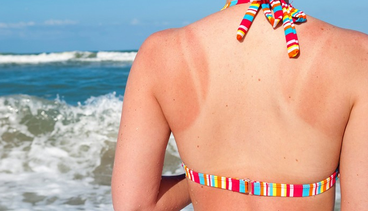 Homemade Remedies Sun Tan