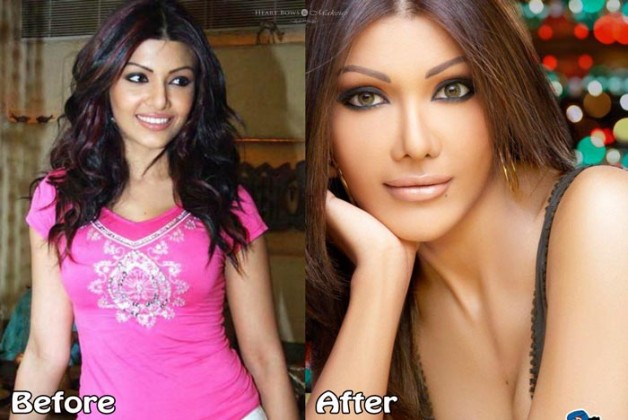 Celebrity Plastic Surgery Disaster Koena Mitra
