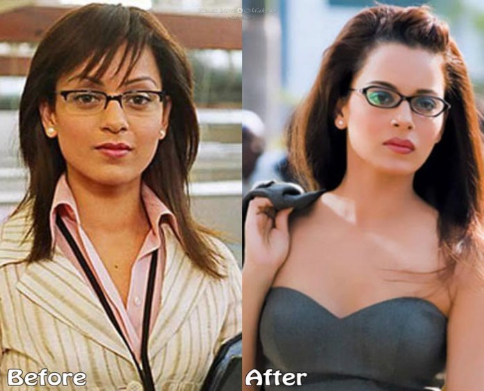 Kangana Ranaut Plastic Surgery
