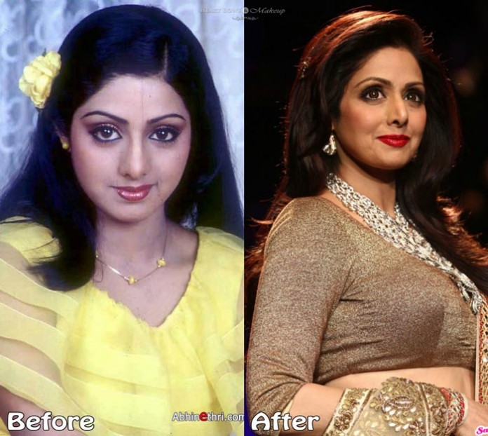 Sridevi Plastic Surgery