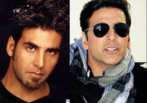 Akshay Kumar take surgery