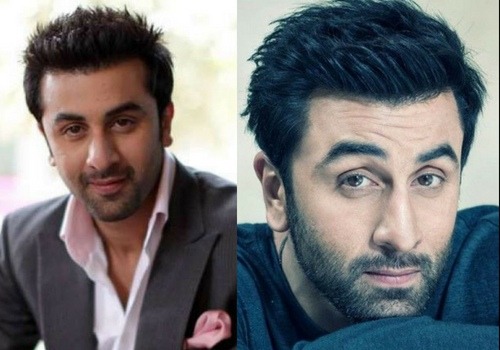 Ranbir Kapoor take surgery