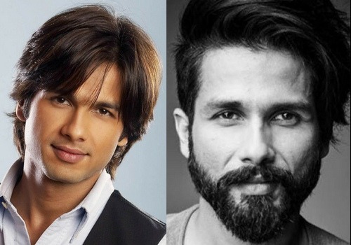 Shahid Kapoor take surgery