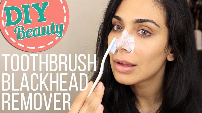 how to get rid of blackheads on nose