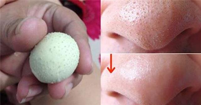 get-rid-of-blackheads-on-nose