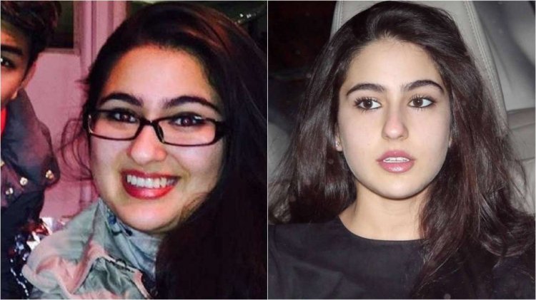 Sara Ali Khan doesn't have a chubby face anymore