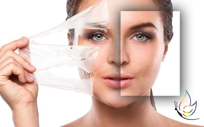 Good Regimen Chemical Peel Fd7e