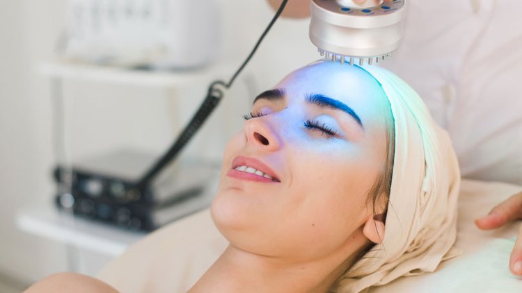 how to get rid of blackheads with laser