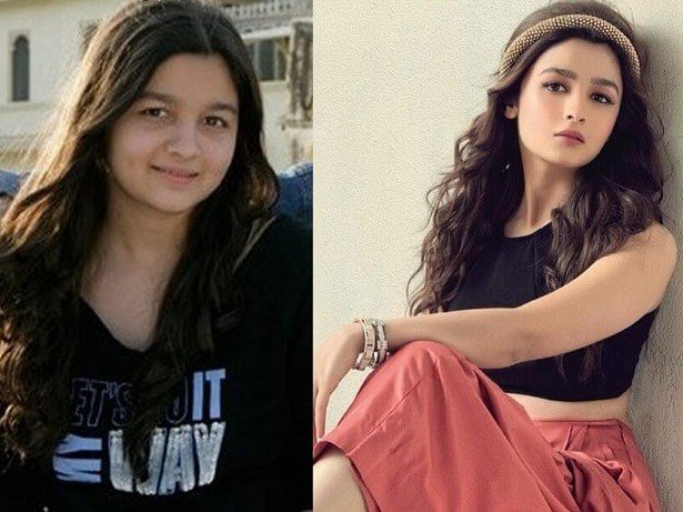 Alia Bhatt Before After