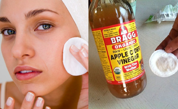 apple-cider-vinegar-for-face-pigmentation3