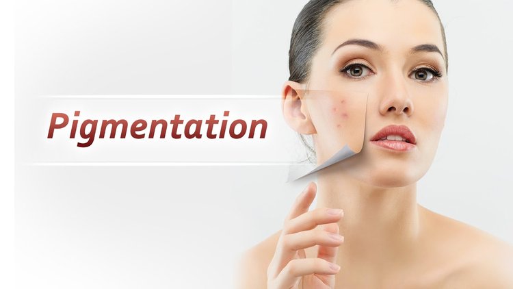 Why-Pigmentation-Comes-On-Face