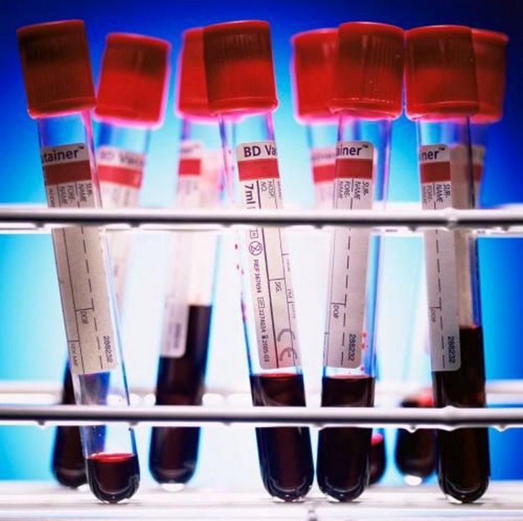 Coronavirus Research