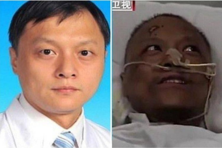 Colour of two Chinese doctors turn dark after long battle with ...