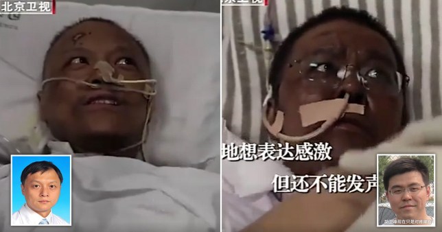 Two Chinese Doctors Turn Black After Recovering Fr