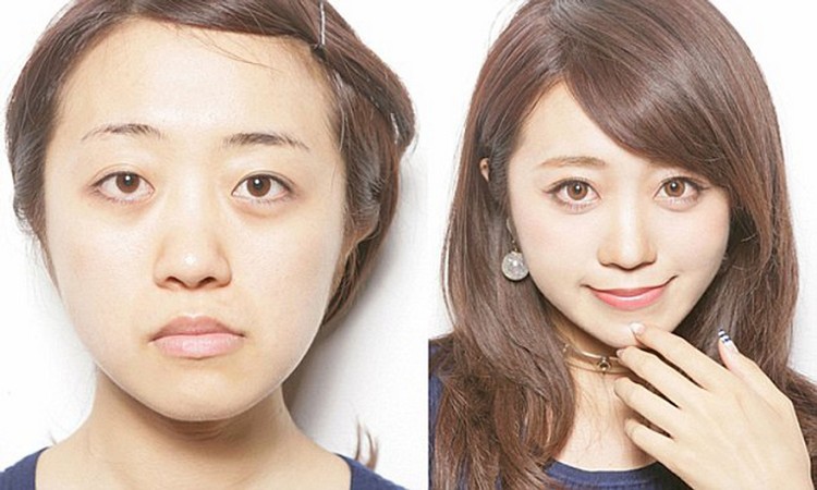 Cosmetic Surgeries In Japan 2