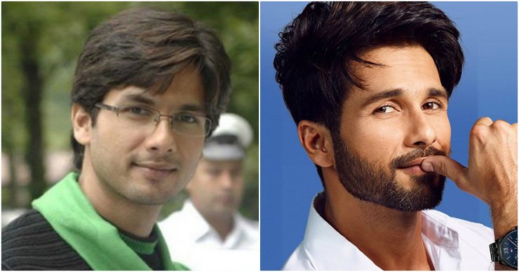 Shahid Kapoor Before And After