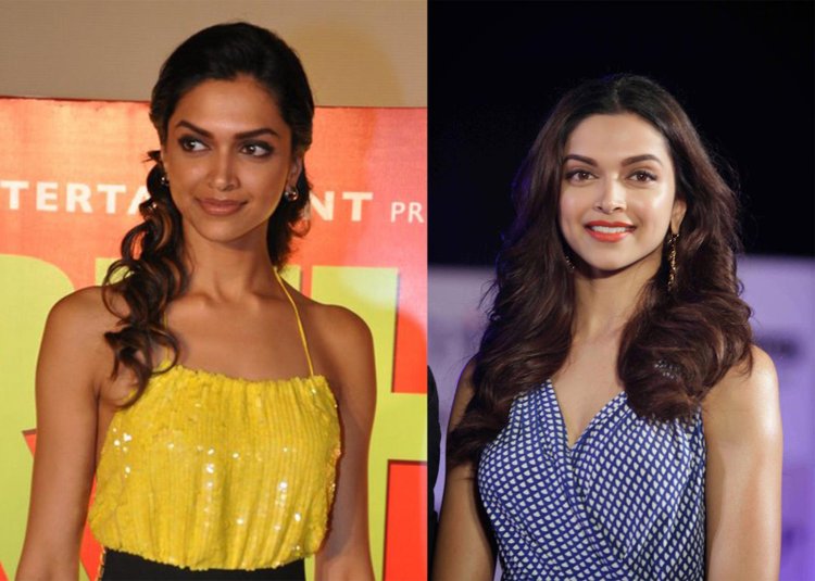 Deepika Padukone Before And After Skin Surgery