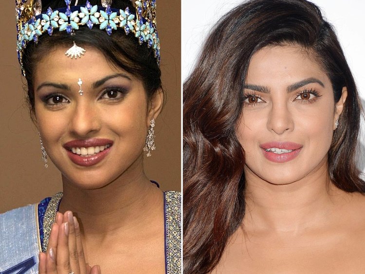 Priyanka Chopra Nose Shape Change